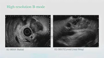 Fujifilm SU1 - Endoscopic Ultrasound System